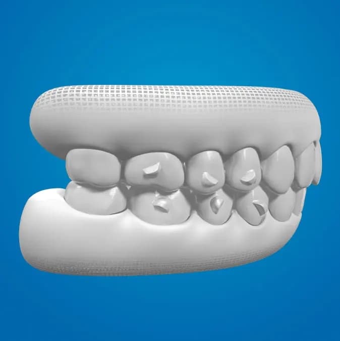 Traitement numérique Invisalign® pour aligneurs | Invisalign.ca